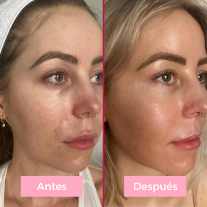 Lifting facial 5 en 1