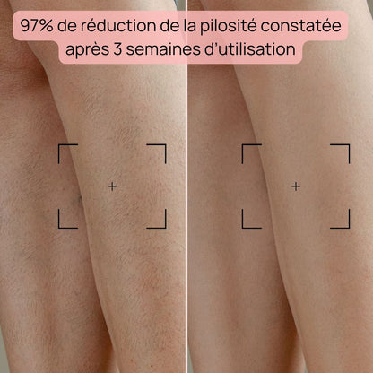 Épilateur à Lumière Pulsée