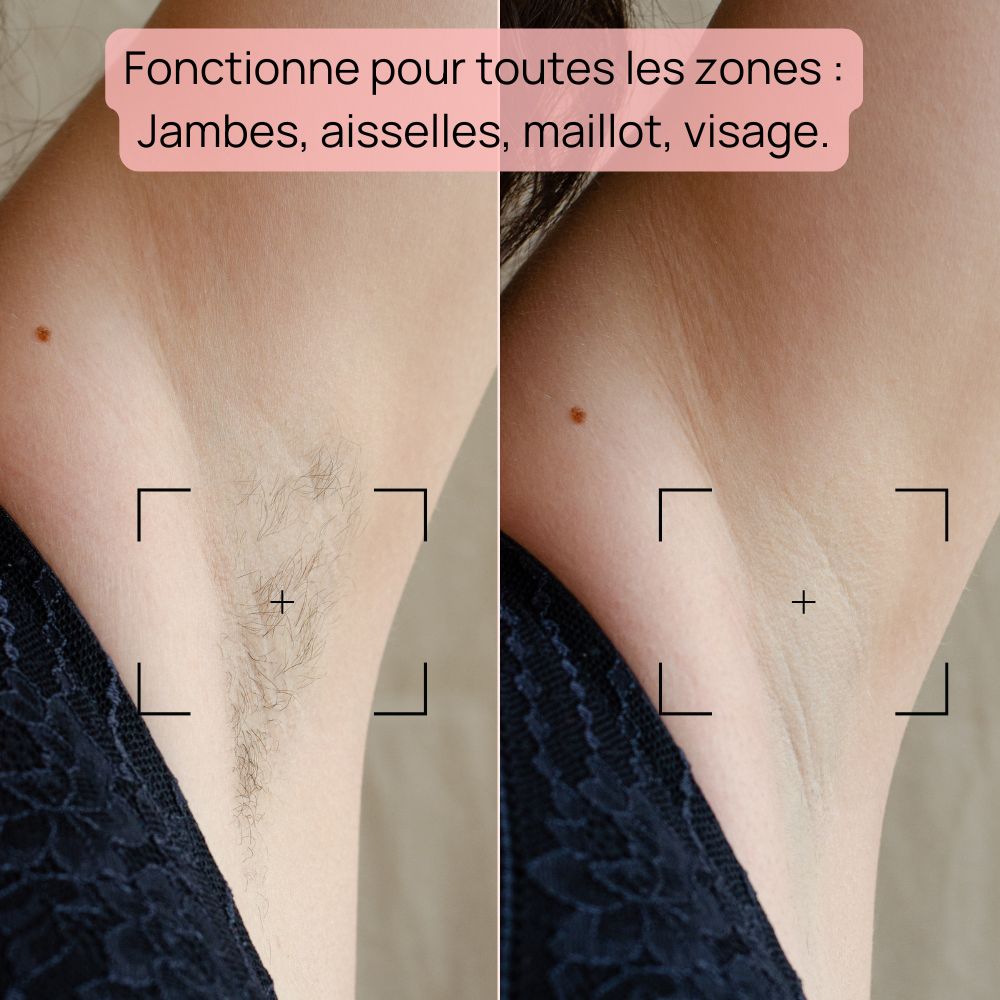 Épilateur à Lumière Pulsée