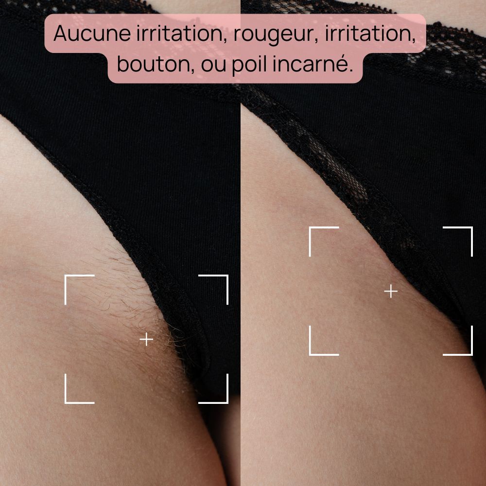 Épilateur à Lumière Pulsée